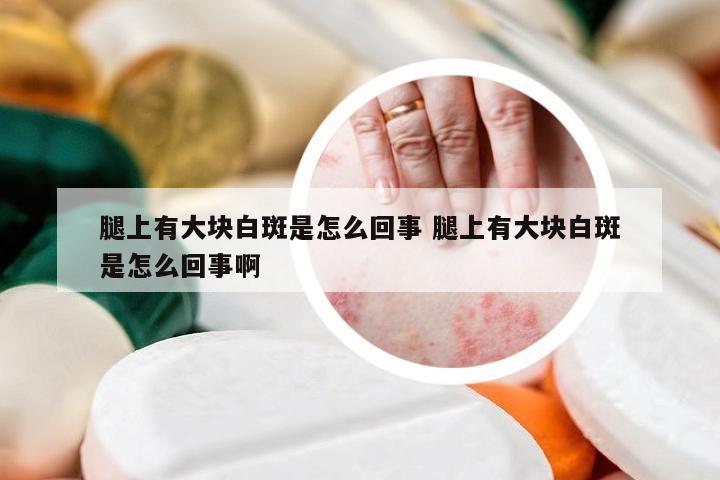 腿上有大块白斑是怎么回事 腿上有大块白斑是怎么回事啊