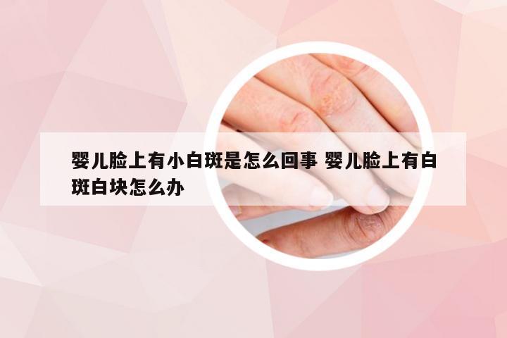 婴儿脸上有小白斑是怎么回事 婴儿脸上有白斑白块怎么办