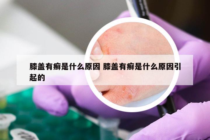 膝盖有癣是什么原因 膝盖有癣是什么原因引起的