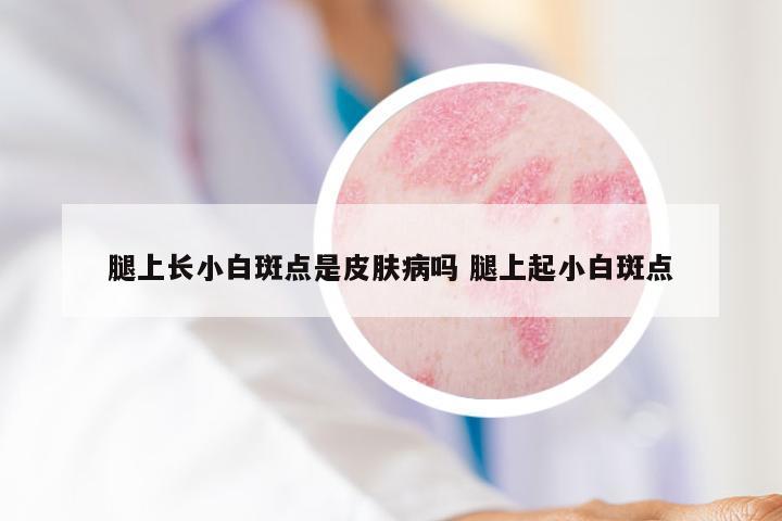 腿上长小白斑点是皮肤病吗 腿上起小白斑点