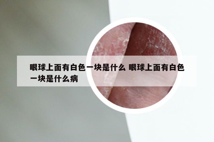 眼球上面有白色一块是什么 眼球上面有白色一块是什么病