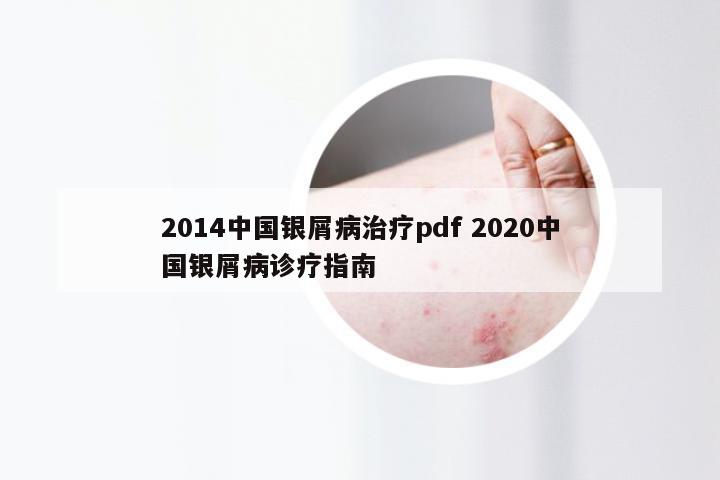 2014中国银屑病治疗pdf 2020中国银屑病诊疗指南