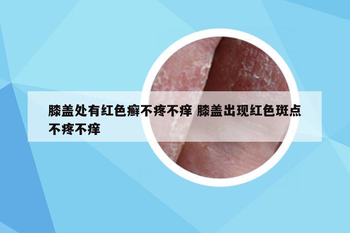 膝盖处有红色癣不疼不痒 膝盖出现红色斑点不疼不痒