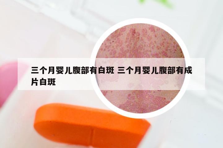 三个月婴儿腹部有白斑 三个月婴儿腹部有成片白斑