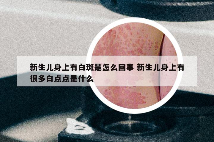 新生儿身上有白斑是怎么回事 新生儿身上有很多白点点是什么