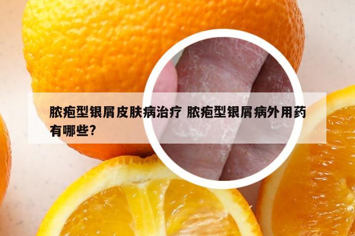 脓疱型银屑皮肤病治疗 脓疱型银屑病外用药有哪些?