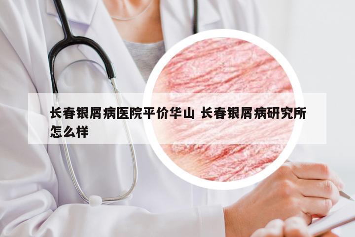 长春银屑病医院平价华山 长春银屑病研究所怎么样