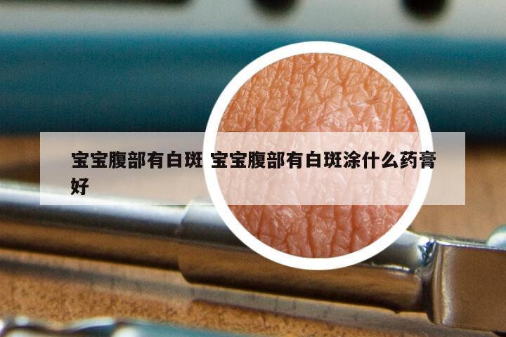 宝宝腹部有白斑 宝宝腹部有白斑涂什么药膏好