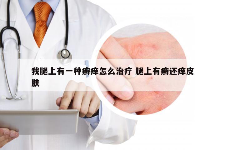 我腿上有一种癣痒怎么治疗 腿上有癣还痒皮肤