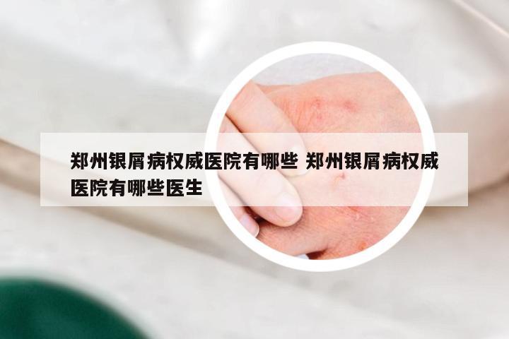 郑州银屑病权威医院有哪些 郑州银屑病权威医院有哪些医生