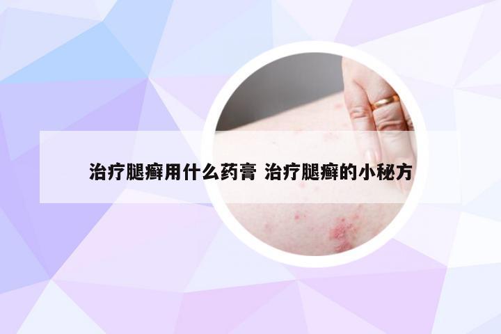 治疗腿癣用什么药膏 治疗腿癣的小秘方