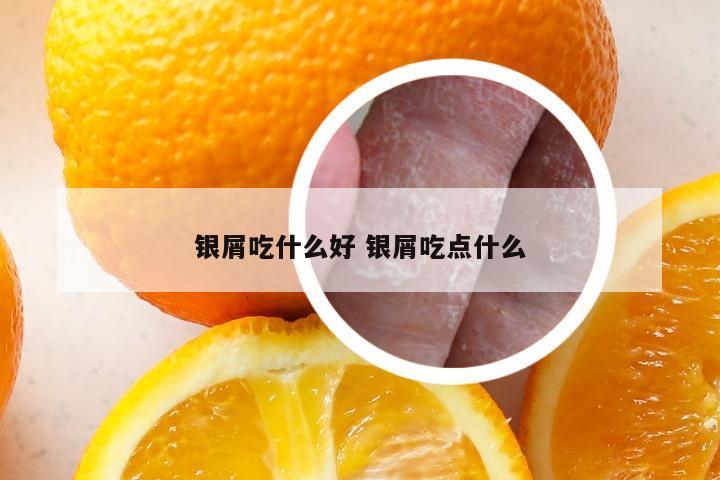 银屑吃什么好 银屑吃点什么