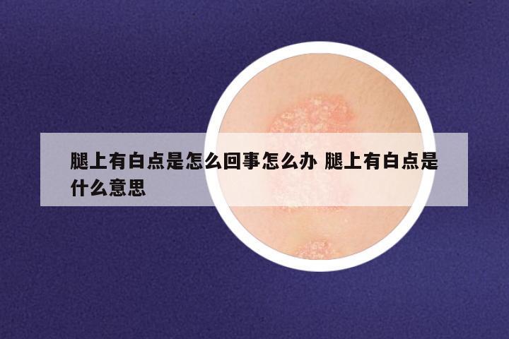 腿上有白点是怎么回事怎么办 腿上有白点是什么意思