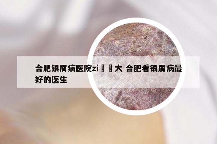 合肥银屑病医院zi詢軍大 合肥看银屑病最好的医生