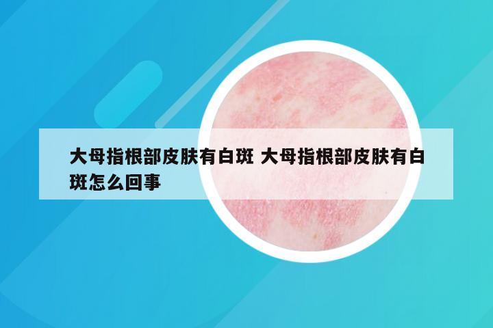 大母指根部皮肤有白斑 大母指根部皮肤有白斑怎么回事