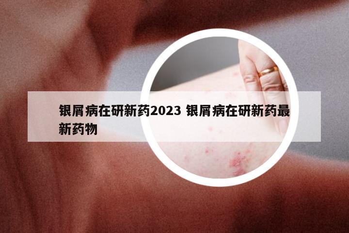 银屑病在研新药2023 银屑病在研新药最新药物