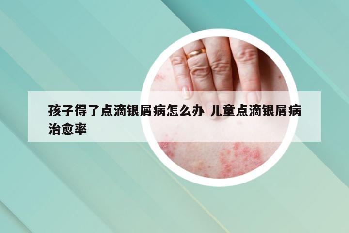 孩子得了点滴银屑病怎么办 儿童点滴银屑病治愈率