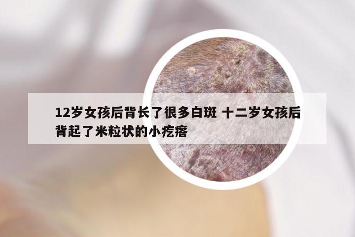 12岁女孩后背长了很多白斑 十二岁女孩后背起了米粒状的小疙瘩