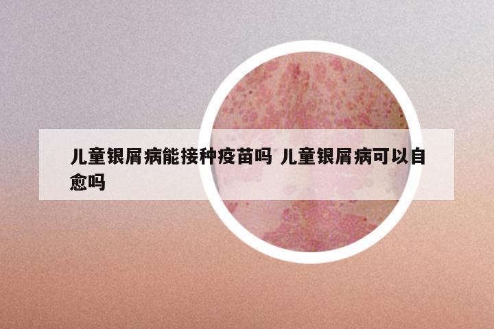 儿童银屑病能接种疫苗吗 儿童银屑病可以自愈吗