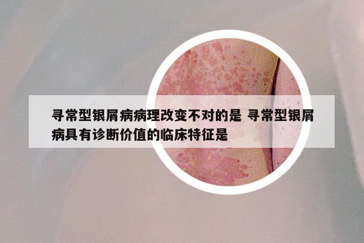 寻常型银屑病病理改变不对的是 寻常型银屑病具有诊断价值的临床特征是