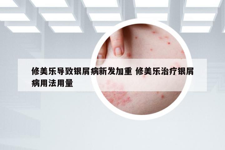 修美乐导致银屑病新发加重 修美乐治疗银屑病用法用量