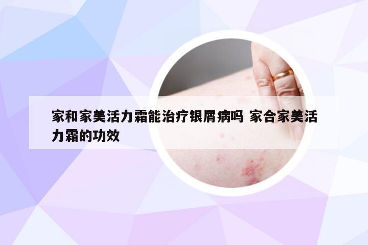 家和家美活力霜能治疗银屑病吗 家合家美活力霜的功效