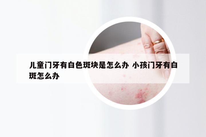 儿童门牙有白色斑块是怎么办 小孩门牙有白斑怎么办