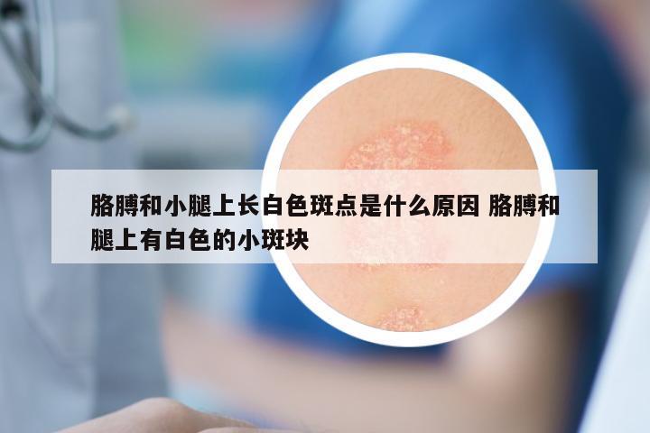 胳膊和小腿上长白色斑点是什么原因 胳膊和腿上有白色的小斑块