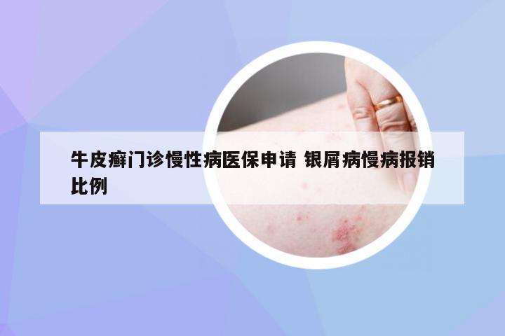 牛皮癣门诊慢性病医保申请 银屑病慢病报销比例