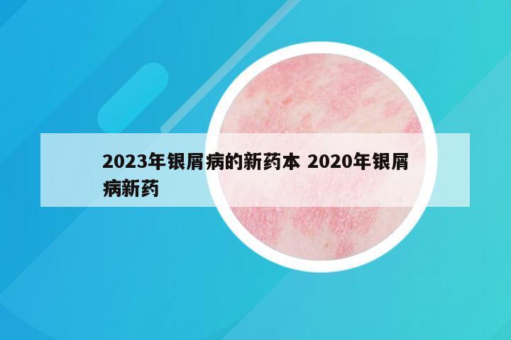 2023年银屑病的新药本 2020年银屑病新药