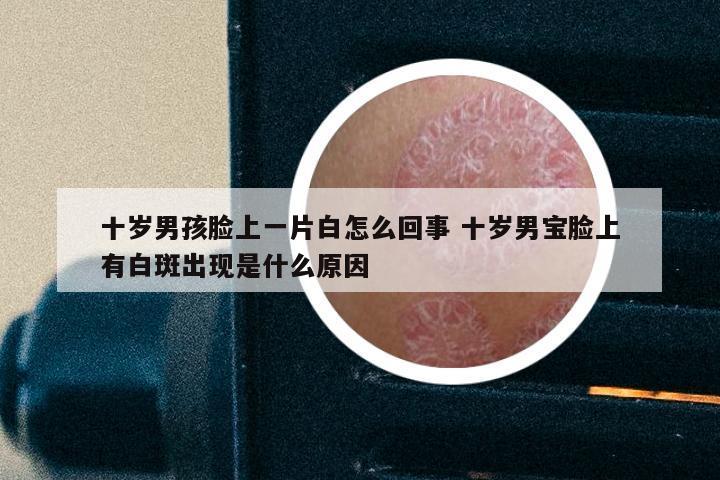 十岁男孩脸上一片白怎么回事 十岁男宝脸上有白斑出现是什么原因