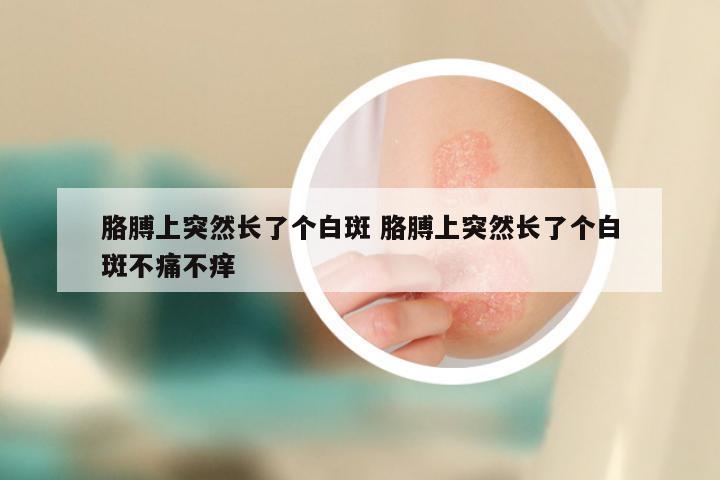 胳膊上突然长了个白斑 胳膊上突然长了个白斑不痛不痒