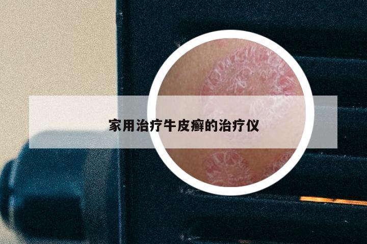 家用治疗牛皮癣的治疗仪