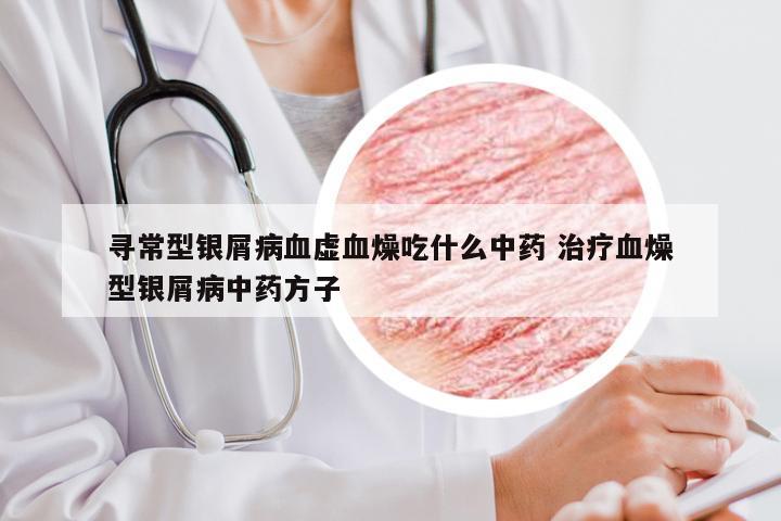 寻常型银屑病血虚血燥吃什么中药 治疗血燥型银屑病中药方子