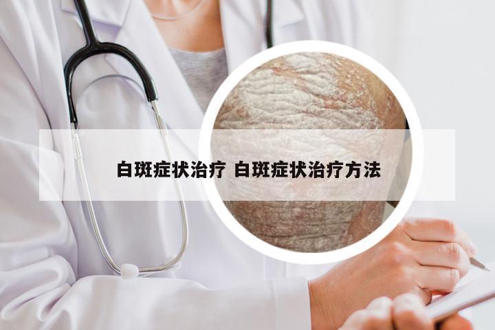 白斑症状治疗 白斑症状治疗方法