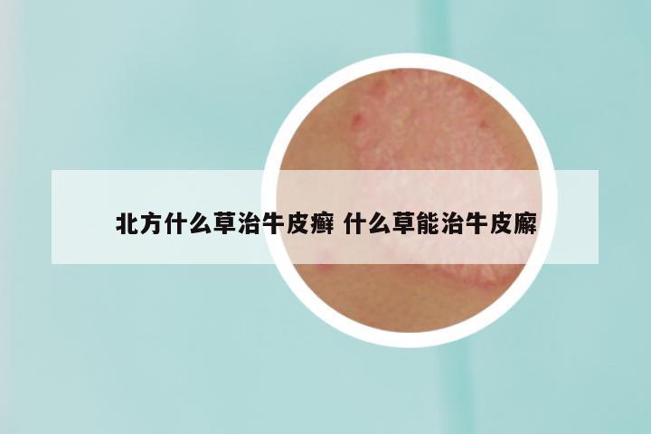 北方什么草治牛皮癣 什么草能治牛皮廨