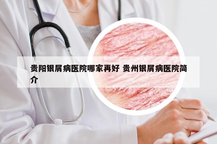 贵阳银屑病医院哪家再好 贵州银屑病医院简介