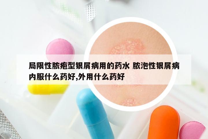 局限性脓疱型银屑病用的药水 脓泡性银屑病内服什么药好,外用什么药好