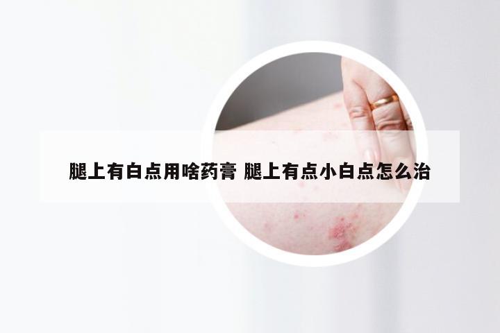 腿上有白点用啥药膏 腿上有点小白点怎么治