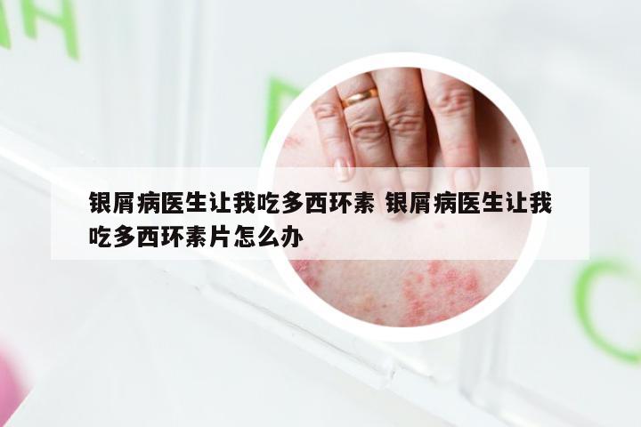 银屑病医生让我吃多西环素 银屑病医生让我吃多西环素片怎么办