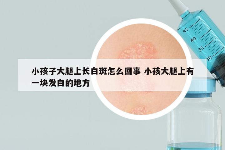 小孩子大腿上长白斑怎么回事 小孩大腿上有一块发白的地方