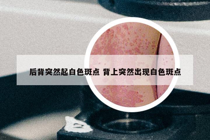 后背突然起白色斑点 背上突然出现白色斑点