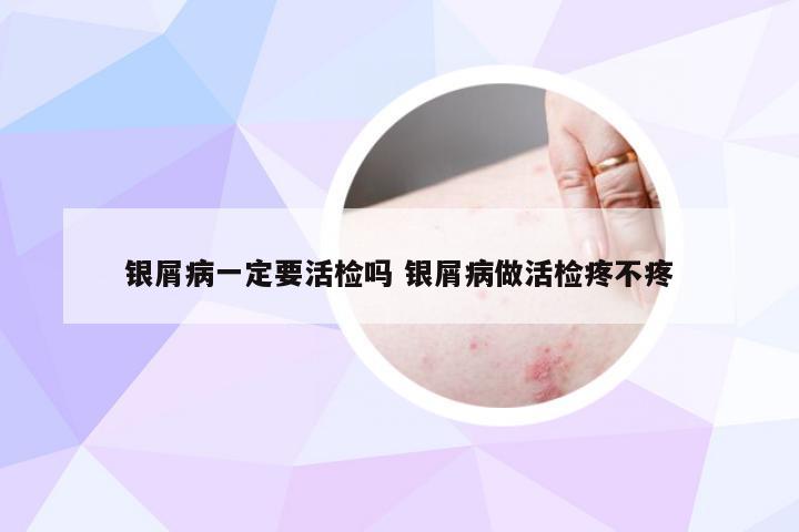 银屑病一定要活检吗 银屑病做活检疼不疼