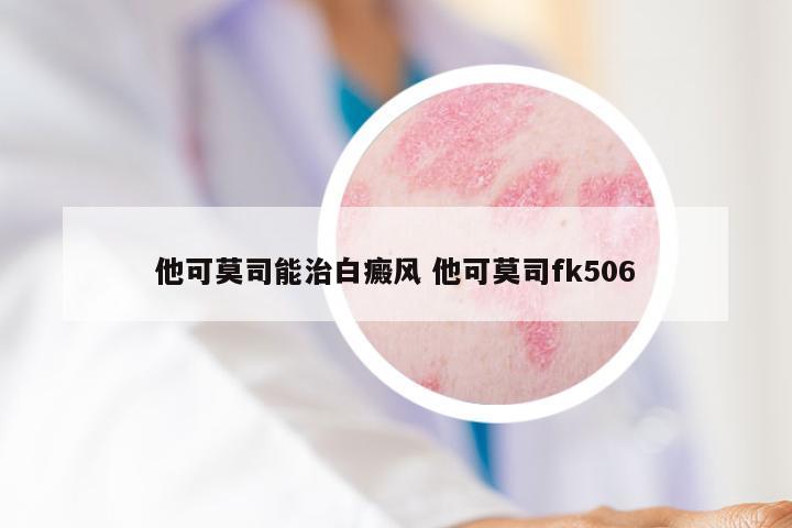 他可莫司能治白癜风 他可莫司fk506