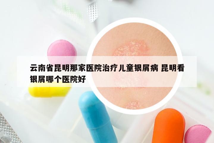 云南省昆明那家医院治疗儿童银屑病 昆明看银屑哪个医院好