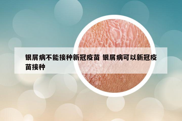 银屑病不能接种新冠疫苗 银屑病可以新冠疫苗接种