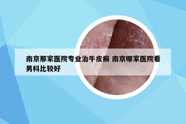 南京那家医院专业治牛皮癣 南京哪家医院看男科比较好