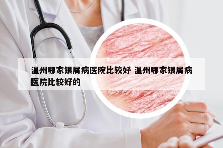 温州哪家银屑病医院比较好 温州哪家银屑病医院比较好的