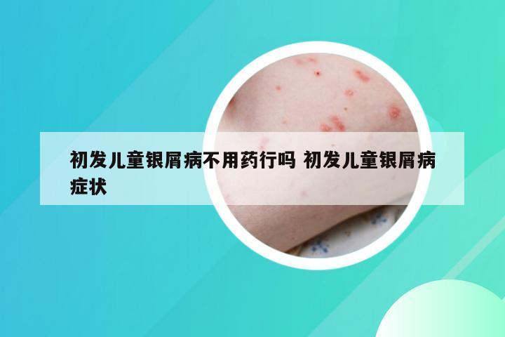 初发儿童银屑病不用药行吗 初发儿童银屑病症状