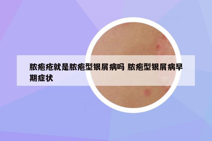 脓疱疮就是脓疱型银屑病吗 脓疱型银屑病早期症状